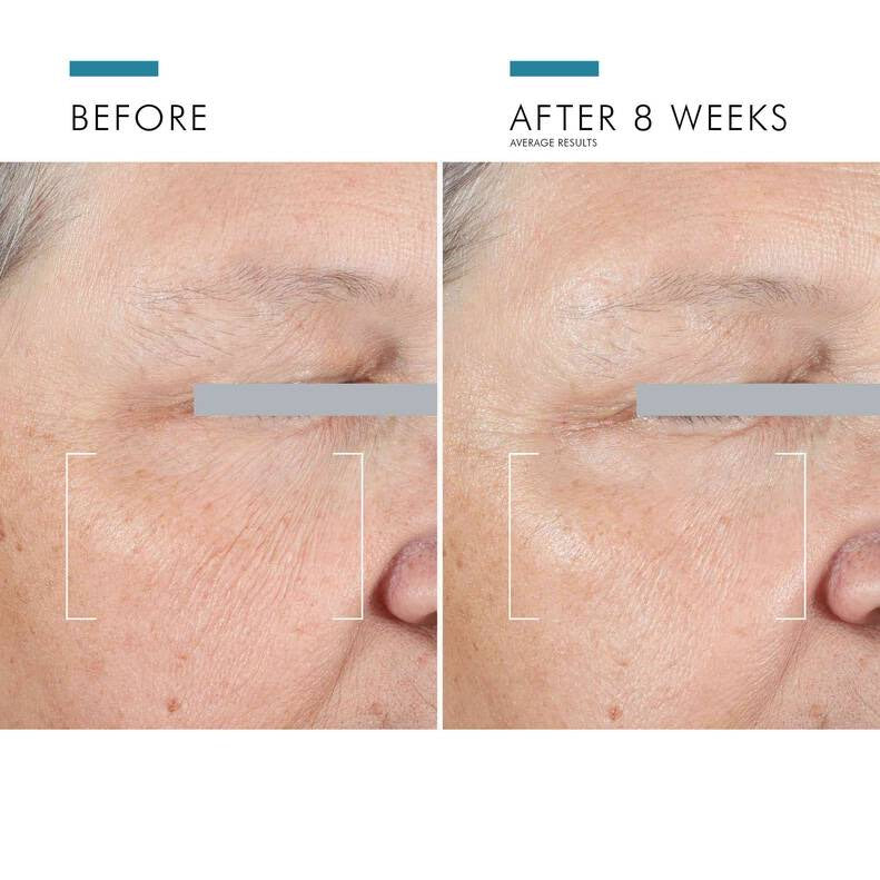 SkinCeuticals A.G.E Advanced Eye Complex