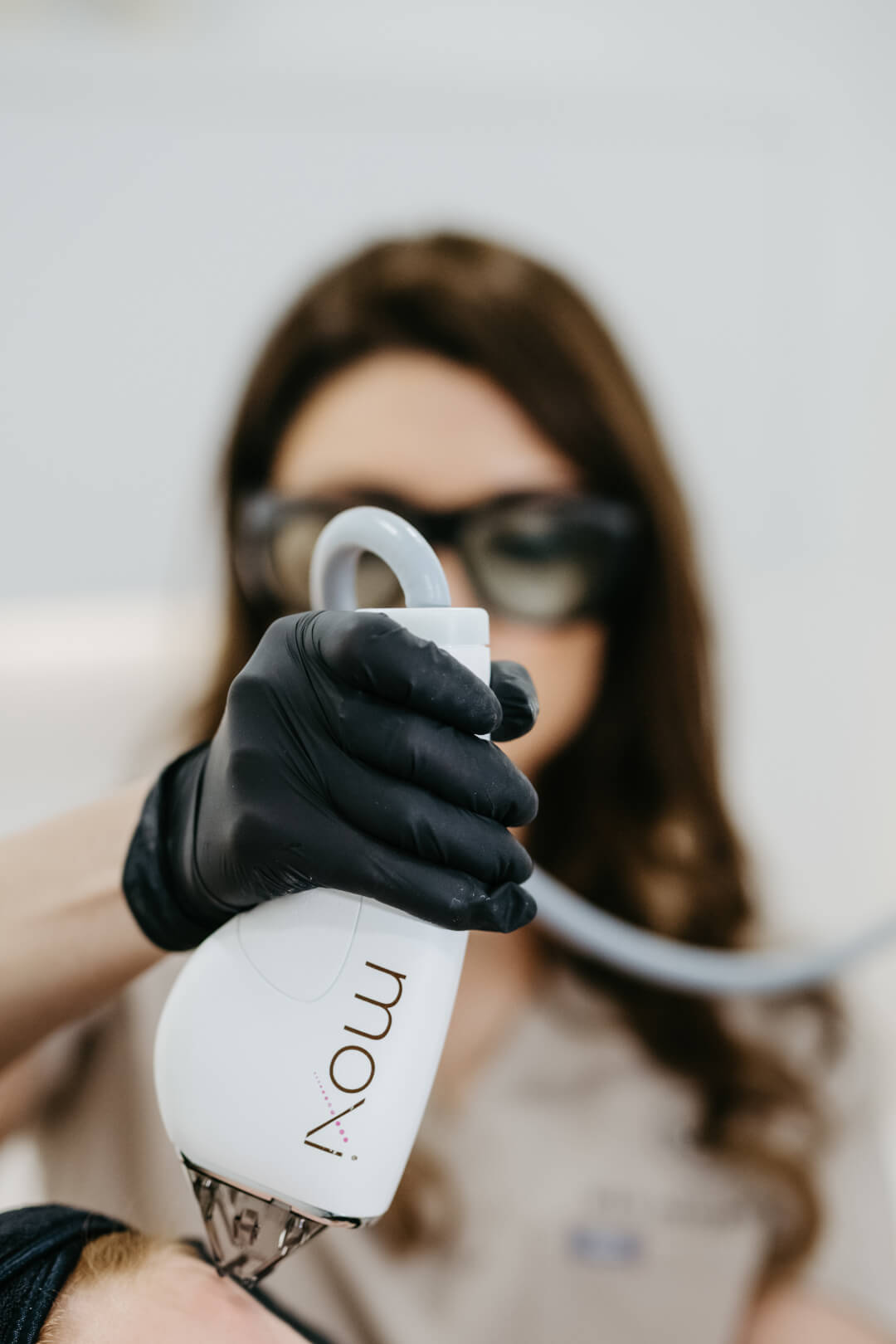 Moxi Laser Treatment Galway