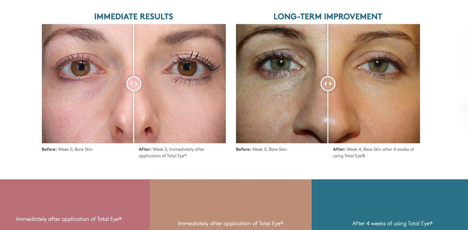 Colorescience Total Eye 3-In-1 Renewal Therapy